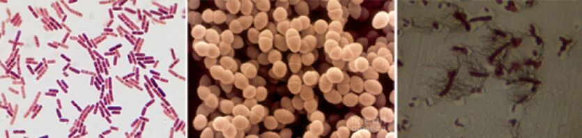 E. coli, fecal enterococcus and proteus are the main causative agents of chronic bacterial prostatitis