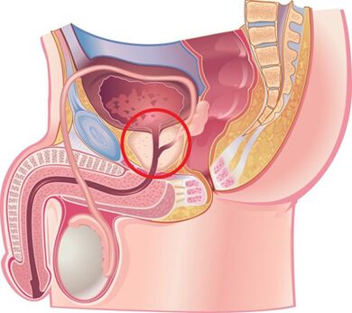 Location of the prostate gland in men