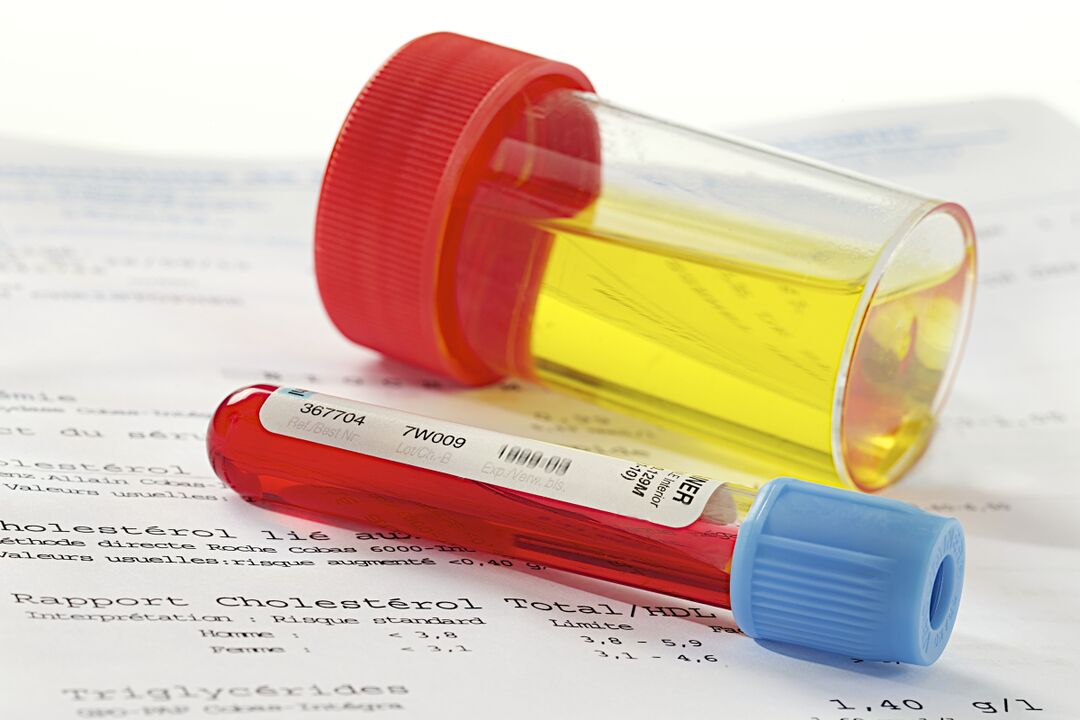 Blood and urine tests will help determine the presence of prostatitis.